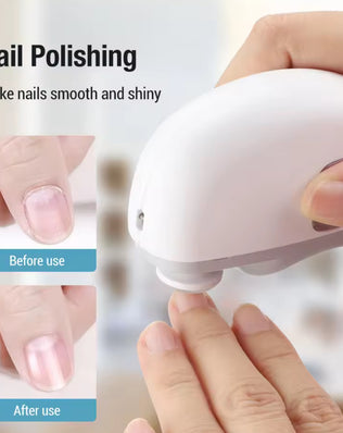Electric Nail Clippers With Light Adult Baby Fingernails - Problems Solved