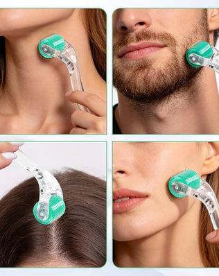 Problems Solved Derma Roller 1.0mm with individual titanium micro needles for skin rejuvenation and collagen stimulation.